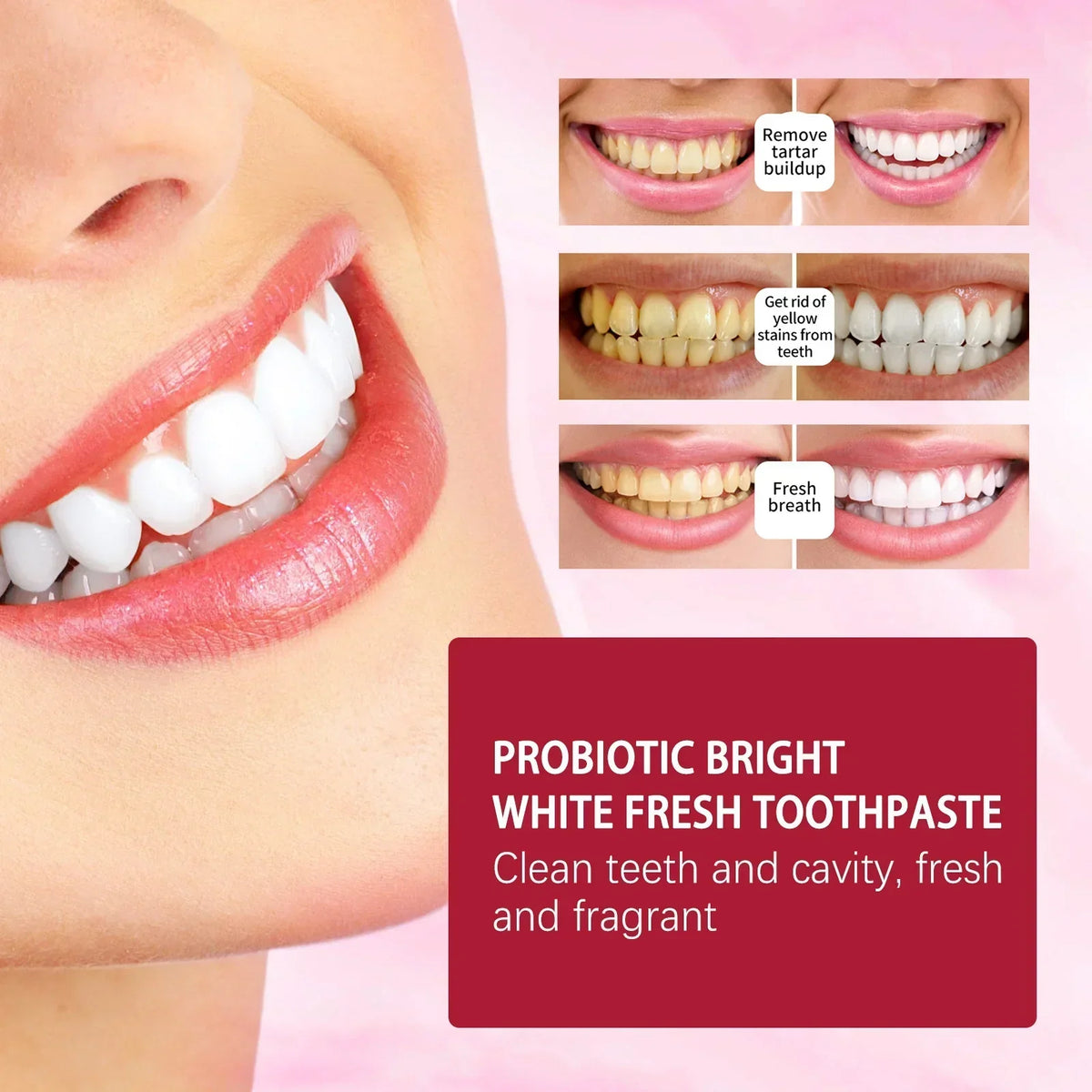 Last Day Of Discount 🔥  SP4  Probiotic Whitening Toothpaste