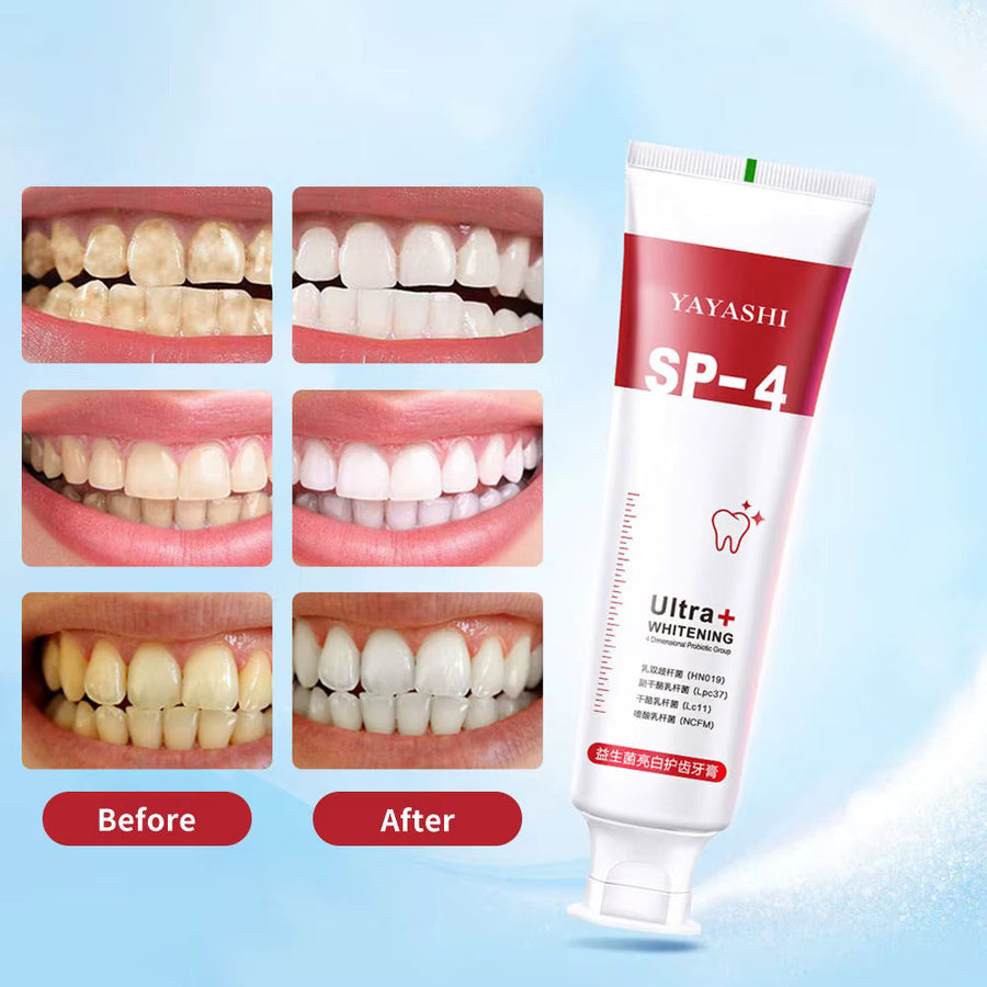 Last Day Of Discount 🔥  SP4  Probiotic Whitening Toothpaste